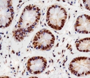 IHC testing of FFPE human colon tissue with RBX1 antibody. HIER: steam section in pH6 citrate buffer for 20 min and allow to cool prior to staining.