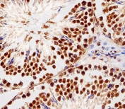 IHC testing of FFPE mouse testis tissue with RBX1 antibody. HIER: steam section in pH6 citrate buffer for 20 min and allow to cool prior to staining.