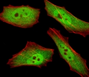 Immunofluorescent staining of fixed and permeabilized human HeLa cells with RBX1 antibody (green) and anti-Actin (red).