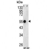 Western blot testing of human WiDr cell lysate in the absence and presence of immunizing peptide with ATP5B antibody. Predicted molecular weight ~56 kDa.