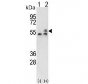 Western blot testing of 1) non-transfected and 2) transfected human 293 cell lysate with ATP5B antibody. Predicted molecular weight ~56 kDa.