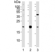 Western blot testing of human 1) A549, 2) HepG2 and 3) U-87 MG cell lysate with Epiregulin antibody. Expected molecular weight ~19 kDa.