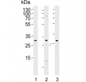 Western blot testing of human 1) KG-1, 2) MCF7 and 3) MDA-MB-453 cell lysate with FOLR2 antibody. Predicted molecular weight ~29 kDa.