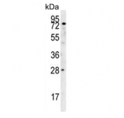 Western blot testing of human HeLa cell lysate with IDUA antibody. Expected molecular weight: 74-85 kDa.