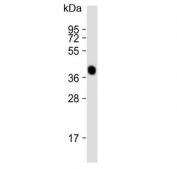 Western blot testing of human liver lysate with AGXT antibody. Predicted molecular weight ~43 kDa.