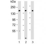 Western blot testing of 1) human Caco-2, 2) mouse kidney and 3) rat liver lysate with ATP7B antibody. Expected molecular weight: 140-157 kDa.