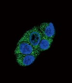 Immunofluorescent staining of fixed and permeabilized human HepG2 cells with ATP7B antibody (green) and DAPI nuclear stain (blue).