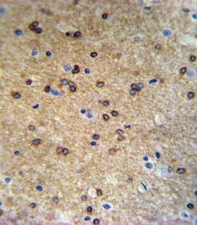 IHC testing of FFPE mouse brain tissue with ATP7B antibody. HIER: steam section in pH6 citrate buffer for 20 min and allow to cool prior to staining.