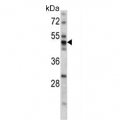 Western blot testing of mouse stomach lysate with PDIA6 antibody. Predicted molecular weight ~48 kDa.