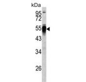 Western blot testing of human Y79 lysate with PDIA6 antibody. Predicted molecular weight ~48 kDa.