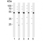 Western blot testing of 1) human K562, 2) human HepG2, 3) human HT-1080, 4) rat C6 and 5) human liver lysate with PDIA6 antibody. Predicted molecular weight ~48 kDa.