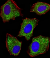 Immunofluorescent staining of fixed and permeabilized human HepG2 cells with PDIA6 antibody (green), DAPI nuclear stain (blue) and anti-Actin (red).