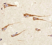 IHC testing of FFPE human brain tissue with PDIA6 antibody. HIER: steam section in pH6 citrate buffer for 20 min and allow to cool prior to staining.