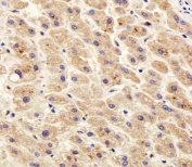IHC testing of FFPE human liver tissue with PDIA6 antibody. HIER: steam section in pH6 citrate buffer for 20 min and allow to cool prior to staining.