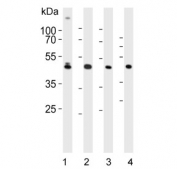 Western blot testing of human 1) HeLa, 2) Jurkat, 3) HT-29 and 4) MOLT4 lysate with GLUL antibody. Predicted molecular weight ~42 kDa.