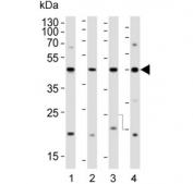 Western blot testing of human 1) HeLa, 2) Raji, 3) Jurkat and 4) HT-29 lysate with GLUL antibody. Predicted molecular weight ~42 kDa.