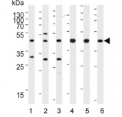 Western blot testing of 1) human HeLa, 2) human HT-29, 3) human Jurkat, 4) mouse brain, 5) mouse cerebellum and 6) rat cerebellum lysate with GLUL antibody. Predicted molecular weight ~42 kDa.