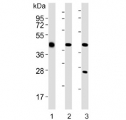 Western blot testing of 1) mouse brain, 2) human HeLa and 3) human Jurkat lysate with GLUL antibody. Predicted molecular weight ~42 kDa.