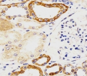IHC testing of FFPE human kidney tissue with GLUL antibody. HIER: steam section in pH6 citrate buffer for 20 min and allow to cool prior to staining.
