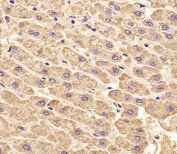 IHC testing of FFPE human liver tissue with GLUL antibody. HIER: steam section in pH6 citrate buffer for 20 min and allow to cool prior to staining.