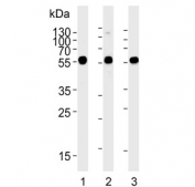 Western blot testing of 1) Jurkat, 2) human Ramos and 3) rat C6 cell lysate with CALR antibody. Expected molecular weight: 46-55 kDa.