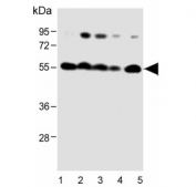 Western blot testing of human 1) HeLa, 2) Jurkat, 3) K562, 4) Ramos and 5) PC-3 cell lysate with CALR antibody. Expected molecular weight: 46-55 kDa.