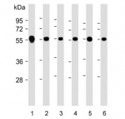 Western blot testing of human 1) Jurkat, 2) HeLa, 3) K562, 4) SH-SY5Y, 5) Ramos and 6) A549 cell lysate with CALR antibody. Expected molecular weight: 46-55 kDa.