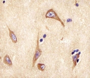 IHC testing of FFPE human brain tissue with NPTX1 antibody. HIER: steam section in pH6 citrate buffer for 20 min and allow to cool prior to staining.