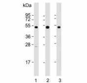 Western blot testing of 1) human brain, 2) mouse brain and 3) rat brain lysate with NPTX1 antibody. Predicted molecular weight ~47 kDa.