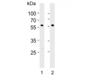 Western blot testing of mouse 1) lung and 2) ovary lysate with RYK antibody. Predicted molecular weight ~68 kDa.