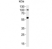 Western blot testing of human ovary lysate with RYK antibody. Predicted molecular weight ~68 kDa.