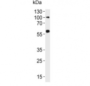 Western blot testing of human ovary lysate with RYK antibody. Predicted molecular weight ~68 kDa.