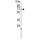 Western blot testing of human U937 cell lysate with SPAK antibody. Predicted molecular weight ~60 kDa.