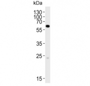 Western blot testing of human HepG2 cell lysate with SPAK antibody. Predicted molecular weight ~60 kDa.