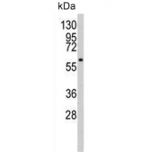 Western blot testing of human HL60 cell lysate with PACSIN1 antibody. Predicted molecular weight ~50 kDa.