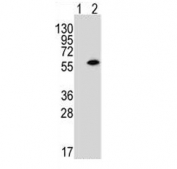 Western blot testing of lysate from 1) non-transfected or 2) transfected human 293 cells with PACSIN1 antibody. Predicted molecular weight ~50 kDa.