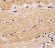 IHC testing of FFPE human skeletal muscle tissue with PRODH antibody. HIER: steam section in pH6 citrate buffer for 20 min and allow to cool prior to staining.