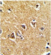 IHC testing of FFPE human brain tissue with PRODH antibody. HIER: steam section in pH6 citrate buffer for 20 min and allow to cool prior to staining.