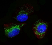 Immunofluorescent staining of fixed and permeabilized human U-251 cells with Glutaminase antibody (green), DAPI nuclear stain (blue) and anti-Actin (red).