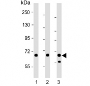 Western blot testing of 1) human brain, 2) mouse brain and 3) human 293T cell lysate with Glutaminase antibody. Predicted molecular weight: 65-73 kDa. 