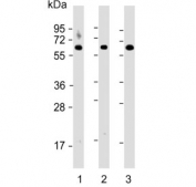 Western blot testing of 1) human brain, 2) human kidney and 3) mouse brain lysate with Glutaminase antibody. Predicted molecular weight: 65-73 kDa. 