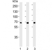 Western blot testing of 1) human brain, 2) mouse brain and 3) rat kidney lysate with Glutaminase antibody. Predicted molecular weight: 65-73 kDa. 