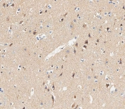 IHC testing of FFPE human brain tissue with Glutaminase antibody. HIER: steam section in pH6 citrate buffer for 20 min and allow to cool prior to staining.