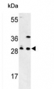Western blot testing of 1) human 293 and 2) mouse kidney lysate with GCLM antibody. Predicted molecular weight ~31 kDa.