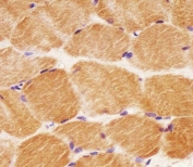 IHC testing of FFPE human skeletal muscle tissue with GCLM antibody. HIER: steam section in pH6 citrate buffer for 20 min and allow to cool prior to staining.