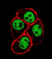 Immunofluorescent staining of fixed and permeabilized human HeLa cells with CDC73 antibody (green) and anti-Actin (red).