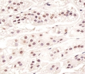 IHC testing of FFPE human adrenal gland tissue with CDC73 antibody. HIER: steam section in pH6 citrate buffer for 20 min and allow to cool prior to staining.