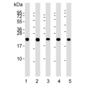 Western blot testing of human 1) ThP-1, 2) 293T, 3) HepG2, 4) SH-SY5Y and 5) human kidney lysate with GPX1 antibody. Predicted molecular weight ~22 kDa.