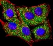 Immunofluorescent staining of fixed and permeabilized human A549 cells with TIMP2 antibody (green), DAPI nuclear stain (blue) and anti-Actin (red).