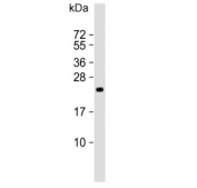 Western blot testing of human HT-1080 cell lysate with TIMP2 antibody. Predicted molecular weight ~24 kDa.